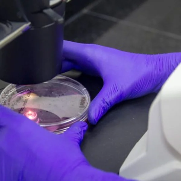 PATENTAN UNA NUEVA MOLECULA PARA CONVATIR EL PARKINSON