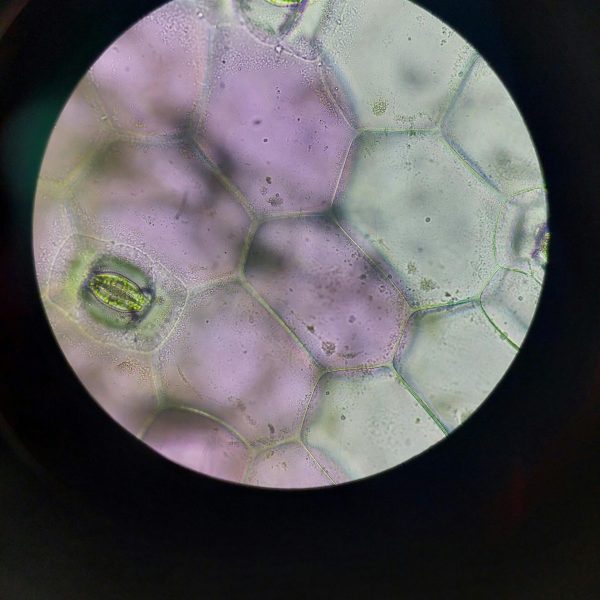 Una radiografía de una célula madre